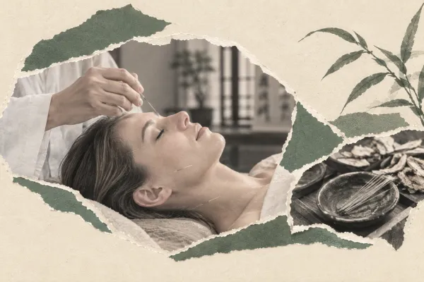 Does Acupuncture Really Work? 10 Questions International Patients Ask Before Treatment in China