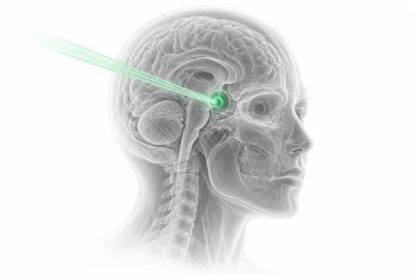 Intensity-Modulated Proton Therapy