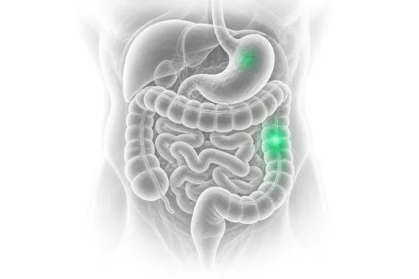 Comprehensive Digestive-Disease Management