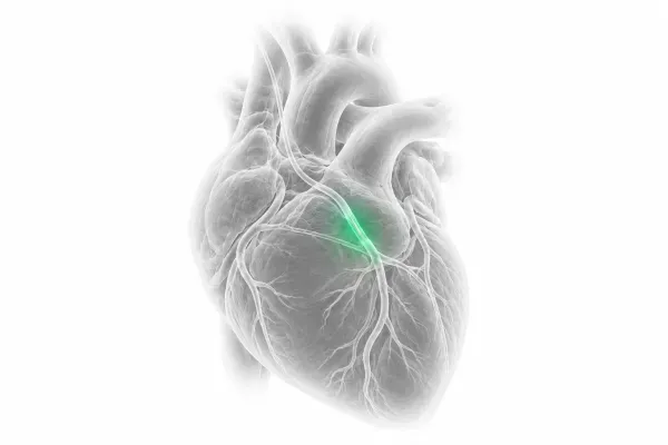 Cardiovascular and Interventional Care