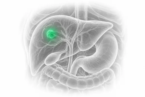Multidisciplinary Cancer Care